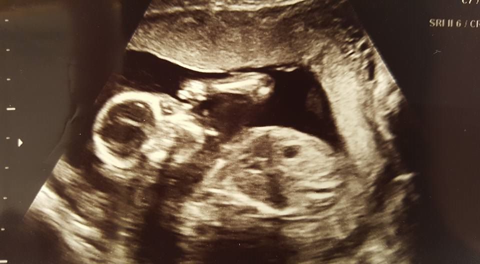 13174031_10209517402081049_7298985113138536118_n-2