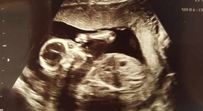 13174031_10209517402081049_7298985113138536118_n-2